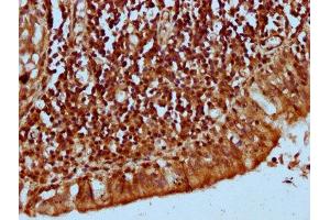 IHC image of ABIN7157277 diluted at 1:300 and staining in paraffin-embedded human lung tissue performed on a Leica BondTM system. (KLHL2 抗体  (AA 1-200))