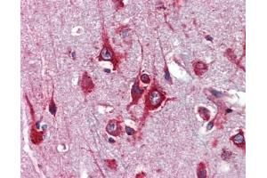 Immunohistochemistry (IHC) image for anti-Transcription Factor AP-2 gamma (Activating Enhancer Binding Protein 2 Gamma) (TFAP2C) (Middle Region) antibody (ABIN927445)