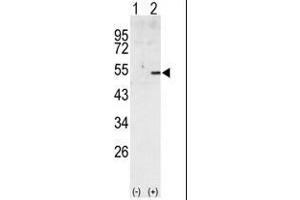 Western blot analysis of CCNA2 (arrow) using rabbit polyclonal CCNA2 Antibody (Cyclin A 抗体  (C-Term))