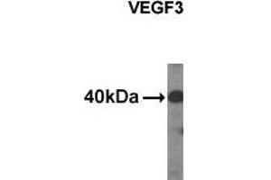 Western analysis of extracts from HDMEC cells using VEGF3 antibody. (VEGFC 抗体  (C-Term, N-Term))