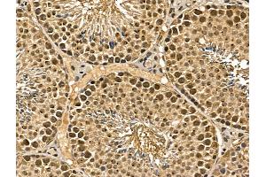 ABIN7094357 and ABIN7098404 at 1/100 staining Mouse testis tissue by IHC-P. (MGAT4C 抗体  (Internal Region))