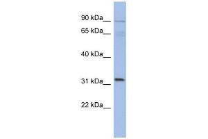 TBC1D14 antibody used at 1 ug/ml to detect target protein. (TBC1D14 抗体  (N-Term))