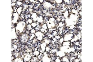 IHC analysis of delta 1 Catenin/CAS/CTNND1 using anti-delta 1 Catenin/CAS/CTNND1 antibody (ABIN7602221).