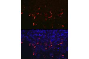 Immunofluorescence (IF) image for anti-Surfactant Protein C (SFTPC) (AA 1-197) antibody (ABIN3015598)
