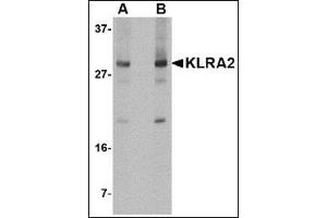 Western blot analysis of KLRA2 in mouse spleen tissue lysate with this product at (A) 0. (Klra2 抗体  (C-Term))