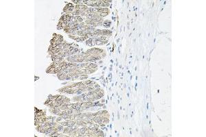 Immunohistochemistry of paraffin-embedded mouse stomach using ATP1B1 antibody (ABIN5973412) at dilution of 1/100 (40x lens). (ATP1B1 抗体)