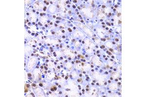 Immunohistochemistry of paraffin-embedded rat pancreas using XRCC4 Antibody (ABIN5970836) at dilution of 1/200 (40x lens). (XRCC4 抗体)