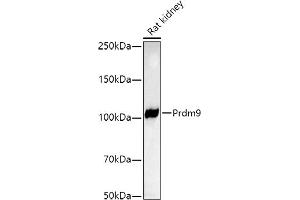 Western blot analysis of extracts of Rat kidney, using Prdm9 antibody (ABIN7269500) at 1:1000 dilution. (PRDM9 抗体)