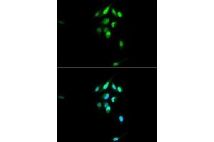 Immunofluorescence analysis of U2OS cells using NR3C1 antibody. (Glucocorticoid Receptor 抗体  (AA 1-280))
