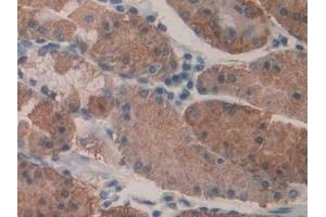 Detection of KARS in Human Stomach Tissue using Polyclonal Antibody to Lysyl tRNA Synthetase (KARS) (KARS 抗体  (AA 323-553))
