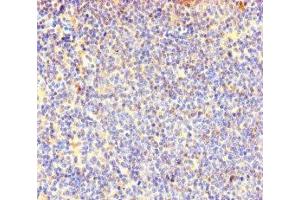 Immunohistochemistry of paraffin-embedded human lymphoid tissue using ABIN7147985 at dilution of 1:100 (COTL1 抗体  (AA 2-142))