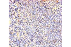 Immunohistochemistry of paraffin-embedded human lymphoid tissue using ABIN7147985 at dilution of 1:100 (COTL1 抗体  (AA 2-142))