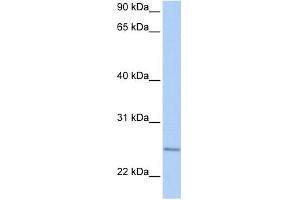 WB Suggested Anti-RABL4 Antibody Titration:  0. (RABL4 抗体  (C-Term))