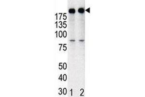 Western blot analysis of anti-HER2 in T47D cell lysate, either noninduced (Lane 1) or induced with HRG (2). (ErbB2/Her2 抗体  (AA 1227-1255))