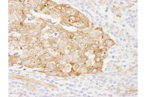 Immunohistochemistry (IHC) image for anti-Reticulocalbin 1, EF-Hand Calcium Binding Domain (RCN1) (AA 1-75) antibody (ABIN7449011) (RCN1 抗体  (AA 1-75))