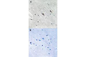 Immunohistochemical staining of human brain tissue by GAB2 (phospho Y643) polyclonal antibody  without blocking peptide (A) or preincubated with blocking peptide (B) under 1:50-1:100 dilution. (GAB2 抗体  (pTyr643))