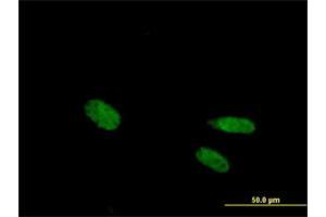 Immunofluorescence (IF) image for anti-Vitamin D Receptor (VDR) (AA 1-427) antibody (ABIN1327643)