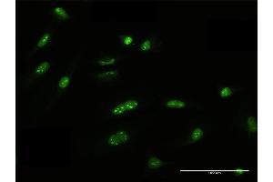 Immunofluorescence of purified MaxPab antibody to FRG1 on HeLa cell. (FRG1 抗体  (AA 1-258))