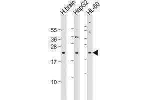 All lanes : Anti-PNOC Antibody (Center) at 1:4000 dilution Lane 1: human brain lysate Lane 2: HepG2 whole cell lysate Lane 3: HL-60 whole cell lysate Lysates/proteins at 20 μg per lane. (PNOC 抗体  (AA 126-151))