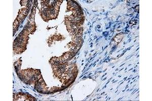 Immunohistochemical staining of paraffin-embedded Kidney tissue using anti-RALBP1 mouse monoclonal antibody. (RALBP1 抗体)