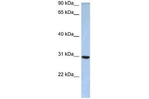 C16ORF65 antibody used at 1 ug/ml to detect target protein. (PDZD9 抗体  (Middle Region))