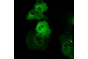 Image no. 9 for anti-Bruton Agammaglobulinemia tyrosine Kinase (BTK) antibody (ABIN1496974) (BTK 抗体)