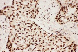 Immunohistochemistry (IHC) image for anti-Arachidonate 5-Lipoxygenase (ALOX5) (AA 120-483) antibody (ABIN3043727)