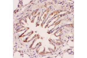 Anti-MyD88 Picoband antibody,  IHC(P): Rat Lung Tissue (MYD88 抗体  (AA 44-264))