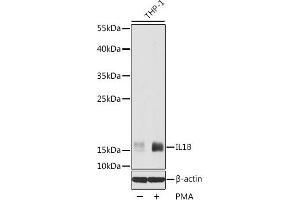 Western blot analysis of extracts of THP-1 cells using IL1 beta Polyclonal Antibody at dilution of 1:1000. (IL-1 beta 抗体)