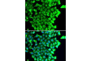 Immunofluorescence analysis of MCF7 cell using TRIAP1 antibody. (TRIAP1 抗体)