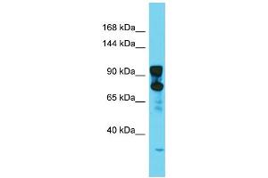 Host: Rabbit  Target Name: Dnm2  Sample Tissue: Rat Testis lysates  Antibody Dilution: 1. (DNM2 抗体  (N-Term))