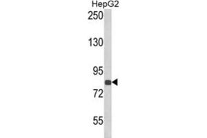 Western Blotting (WB) image for anti-Endothelin-Converting Enzyme 1 (ECE1) antibody (ABIN3002835)