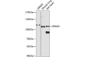 Western blot analysis of extracts of various cell lines, using EPH antibody (ABIN6131627, ABIN6140213, ABIN6140214 and ABIN6224468) at 1:1000 dilution. (EPH Receptor A3 抗体  (AA 400-545))