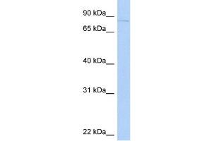 WB Suggested Anti-KIF2C Antibody Titration:  0. (KIF2C 抗体  (N-Term))