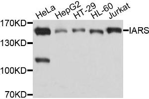 Western blot analysis of extracts of various cells, using IARS antibody. (IARS 抗体)