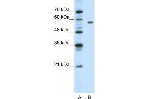 WB Suggested Anti-PBX2 Antibody Titration:  1. (PBX2 抗体  (C-Term))