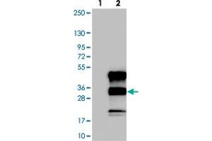 Western blot analysis of Lane 1: Negative control (vector only transfected HEK293T lysate). (C12orf43 抗体)