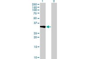 Western Blotting (WB) image for anti-Corticotropin Releasing Hormone Binding Protein (CRHBP) (AA 1-322) antibody (ABIN514595)