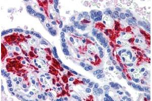 Placenta, Human: Formalin-Fixed, Paraffin-Embedded (FFPE) (DDX58 抗体)