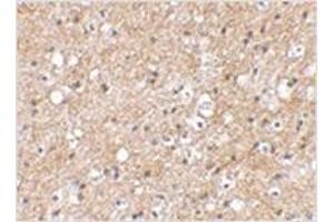 Immunohistochemical staining of human brain tissue using IPR1 antibody at 2. (SP110 抗体  (C-Term))