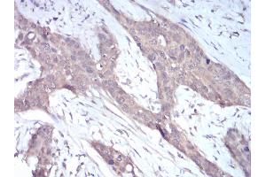 Immunohistochemistry (IHC) image for anti-NADPH Oxidase 4 (NOX4) (AA 210-310) antibody (ABIN5542344)