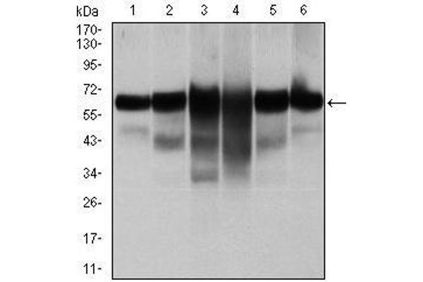 Cytokeratin 5 抗体