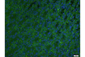 Paraformaldehyde-fixed, paraffin embedded rat stomach; Antigen retrieval by boiling in sodium citrate buffer (pH6. (ADCK4 抗体  (AA 65-170))