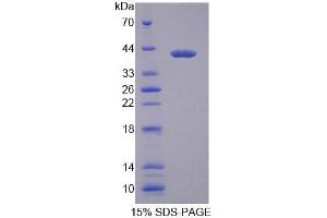 SDS-PAGE analysis of Mouse MYH1 Protein.