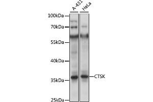 Western blot analysis of extracts of U-87MG cells, using CTSK antibody (ABIN6127669, ABIN6139234 and ABIN7101787) at 1:400 dilution. (Cathepsin K 抗体  (AA 115-329))