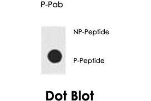 Dot blot analysis of AKT1 (phospho S129) polyclonal antibody  on nitrocellulose membrane. (AKT1 抗体  (pSer129))
