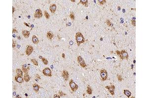 Immunohistochemistry analysis of parafffin-embedded mouse brain using NTS Polyclonal Antibody at dilution of 1:300. (Neurotensin 抗体)
