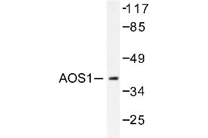 Image no. 1 for anti-SUMO1 Activating Enzyme Subunit 1 (SAE1) antibody (ABIN271943) (SAE1 抗体)