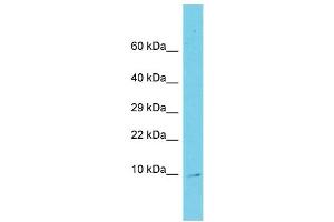 Host: Rabbit Target Name: C11orf75 Sample Type: Fetal Liver lysates Antibody Dilution: 1. (SMCO4 抗体  (N-Term))