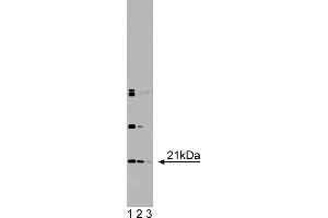Western Blotting (WB) image for anti-Dihydrofolate Reductase (DHFR) (AA 1-186) antibody (ABIN968119) (Dihydrofolate Reductase 抗体  (AA 1-186))